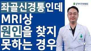 MRI상, 원인을 찾을 수 없는 근육성 좌골신경통의 특징과 치료법