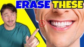 Reverse DEEP Smile Lines Instantly | Chris Gibson