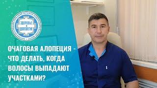  Очаговая алопеция   что делать, когда волосы выпадают участками?