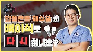 압구정임플란트재수술 - 임플란트재수술 시 뼈이식도 다시 한다? (Do I need to re-implant a bone graft during re-implant surgery?)