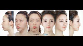 Eng sub) ID Hospital : Let Me In 5, Korea Plastic Surgery Part 1