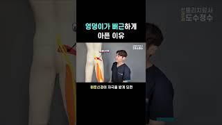 엉덩이가 뻐근하다면 확인해보세요 - 상둔피신경 자극에 의한 엉덩이 근육의 뻐근한 허혈성 통증