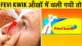 FeviKwik आंखों में चला जाए तो? | 18 Amazing Random Facts | Rewirs Facts