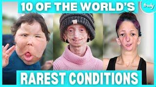 10 Incredible People Who Defied The Rarest Conditions | BORN DIFFERENT