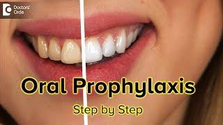 Oral Prophylaxis Step by Step - Dr. Gopathi Haritha