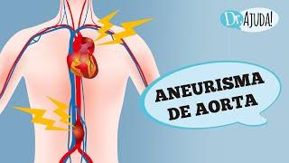 ANEURISMA DE AORTA: O QUE É? SINTOMAS E TRATAMENTO