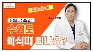 수염 이식이란??  모발이식병원 I 헤어라인교정 I 맘모스