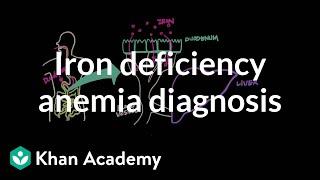 Iron deficency anemia diagnosis | Hematologic System Diseases | NCLEX-RN | Khan Academy