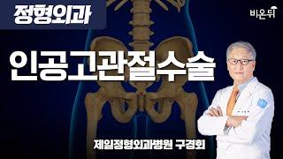 인공고관절수술 / 제일정형외과병원 구경회