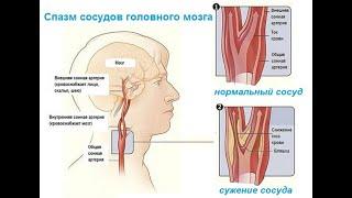 Самодиагностика ЗАСТОЯ В СОСУДАХ ГОЛОВНОГО МОЗГА  Шаги решения  Кирилл Вершилов Аврора
