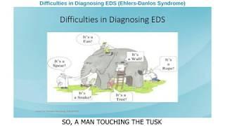 Difficulties in Diagnosing EDS