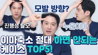 저는 이마축소를 할 수 없다구요?! 이마축소 절대 하면 안되는 케이스 TOP 5