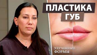  Красивые губы без филлеров: что такое булхорн?