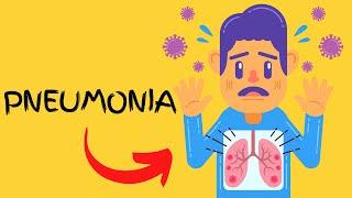 What is Pneumonia - Symptoms, Causes, Types