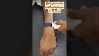 butterfly  cannula insertion technique ‍️ medico info 🩺 nursing officer‍️ health department