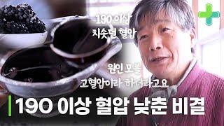 '혈압이 190이 넘었더라고요', 전조증상 하나 없이 갑자기 온 고혈압 완치했다?