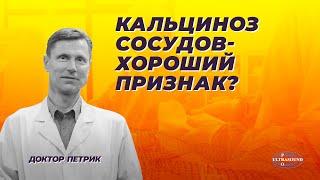 Кальциноз сосудов - хороший признак?