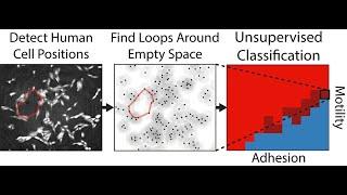 Ian Wong: Topological data analysis of collective cell migration