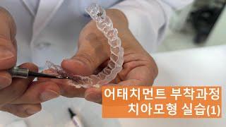 인비절라인 어태치먼트 붙이기 (치아모형) Part1. 붙이기