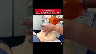 C-E Grip in Bag Mask Ventilation | #anesthesia #bagmaskventilation #airway