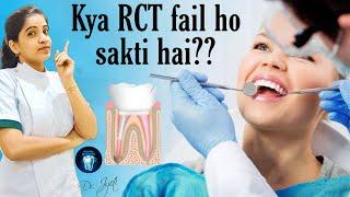 kya RCT fail ho sakti hai?? | dental maestro | Dr Jyoti Agarwal