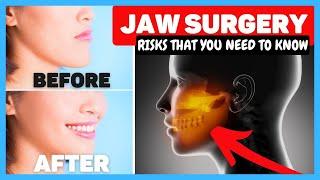 Corrective Jaw Surgery Recovery & Cost {Dentist REVIEW of Orthognathic Surgery}