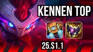 KENNEN vs DR. MUNDO (TOP) | KR Diamond | 25.S1.1