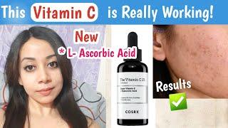 *New* Cosrx Vitamin C 23% Serum Review| Vitamin C serum for face| Pigmentation, Tan Removal