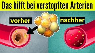 Das reinigt verstopfte Arterien und kontrolliert den Blutdruck!