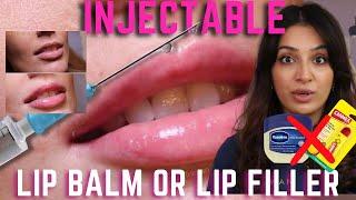 Injectable Lip Balm for Hydrated and Plump Lips | YOU DON’T NEED LIP FILLER