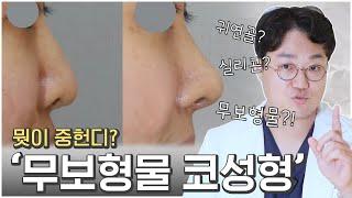 실리콘 없이도 코수술이 가능하다?! 무보형물 코성형이 가능한 경우는?