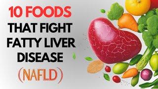 Nonalcoholic Fatty Liver: Best Foods for Prevention Q&A