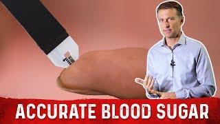 The Most Accurate Method To Test Blood Sugar is NOT A1C Test – Dr. Berg