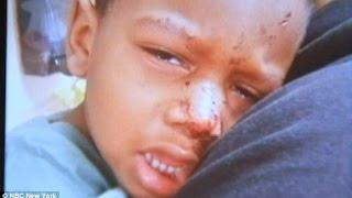 3-Year Old Brooklyn Autistic Boy Is BRUTALLY ATTACKED By RATS In His Sleep!!