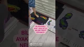 Bilgisayarlı ayak analizi ve yürüme analizi nasıl yapılır?