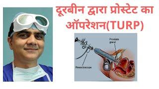 Turp Surgery in Delhi - Dr Ashish Saini, the Best Urologist In Delhi