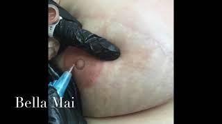 Medical 3D Areola Tattooing