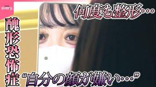 【知ってほしい私のこと】“自分の顔が醜い”と強い不安に襲われ“整形”繰り返す…「醜形恐怖症」に苦しむ女性の思い『every.特集』