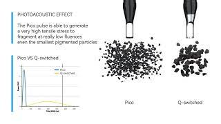 Picosecond Laser VS Q Switched Laser