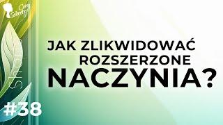 JAK ZLIKWIDOWAĆ ROZSZERZONE NACZYNKA?