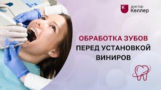 Обработка зубов перед установкой виниров