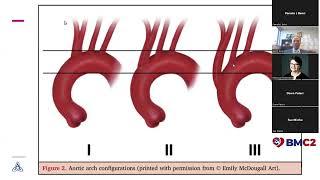 Dr. Jason T. Ryan Presents "Aortic Arch Types."