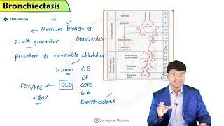 4. Bronchiectasis 🫁 | Causes, HRCT Signs & Management Simplified | NEET PG, USMLE, FMGE High-Yield 