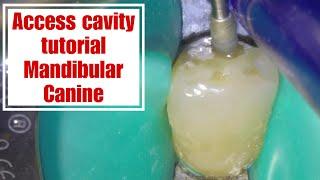 Access cavity mandibular Canine tutorial