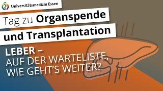 Voraussetzung zur Listung der Leber: Auf der Warteliste – wie geht´s weiter?