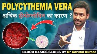 What is Polycythemia Vera | Erythrocytosis Vs  Blood Cancer | Dr Karuna Kumar