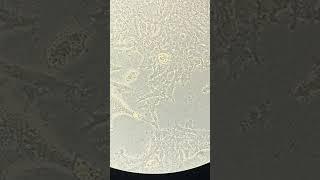 Bacterial Growth in HEK293T cells #contamination #cellculture #bacterialgrowth