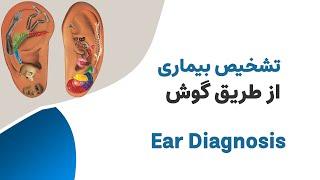 تشخیص بیماری از طریق گوش --- Ear / Auricular Diagnosis