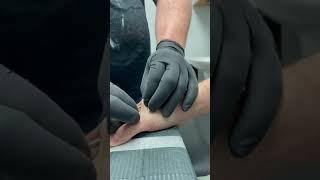 Implanting a magnet in my hand #shorts #magnetimplant #youtubeshorts #cyborg #biohacker