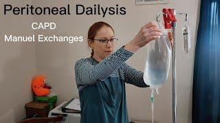 Peritoneal Dialysis (PD) Manual Exchanges: Step-by-Step Guide in 2023